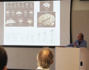 A man gives a lecture on brain structures, using a presentation screen with various brain images and data charts.